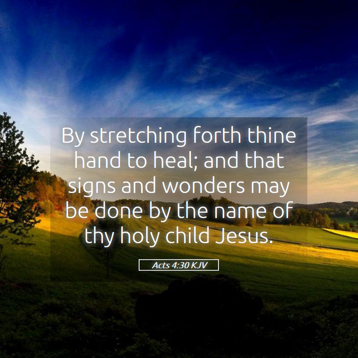 Acts 4:30 KJV Bible Study